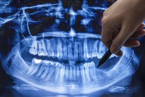 Ease of Transferring Dental Records