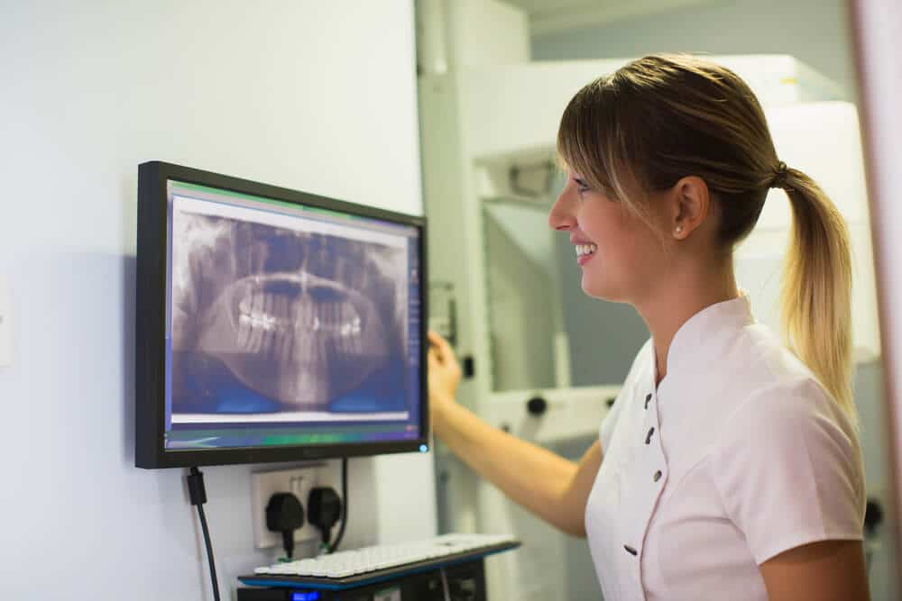 Advantages of Digital X-rays for Dental Practices